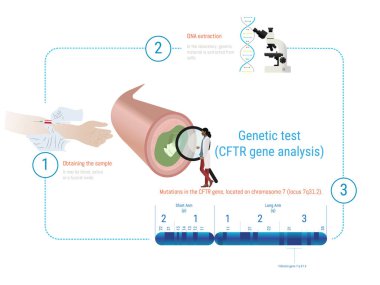 Kistik fibrozis tanısı sürecini gösteren tıbbi bilgiler, kan örneği toplama, DNA çıkarma ve 7 numaralı kromozom üzerindeki cftr gen analizi, mutasyonları vurguluyor.