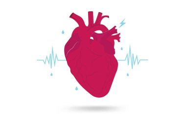 Kalp hastalığından muzdarip, kalp atışları düzensiz ve nabzı zayıf, kalp ve sağlık sorunları belirtileri gösteriyor.