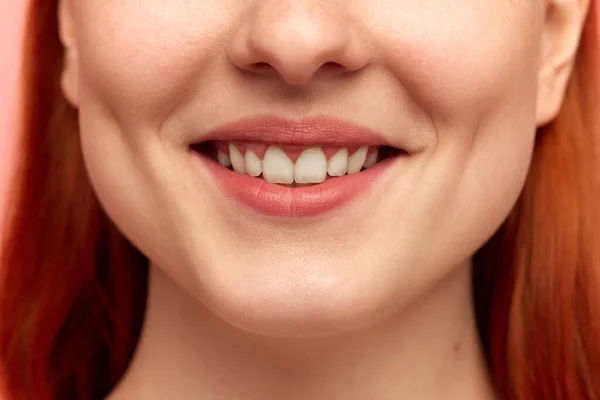 牙齿变白了 剪下年轻女子的画像 脸上挂着雪白的笑容 关闭图像 模型与保存良好 完美皮肤 口腔医学 牙齿治疗 美容美发 健康概念 — 图库照片