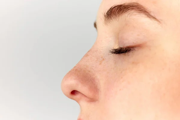 Nasenkorrektur Junge Frau Mädchen Demonstriert Nase Nach Vor Der Operation — Stockfoto