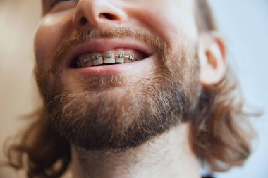 Geniş tebessümlü, sakallı bir gencin kesilmiş portresi. Seçici odaklanma. Mükemmel bir gülümseme ve keyifli bir müşteri. Güzellik ve ilaç kavramı, sağlık, yaşam tarzı.