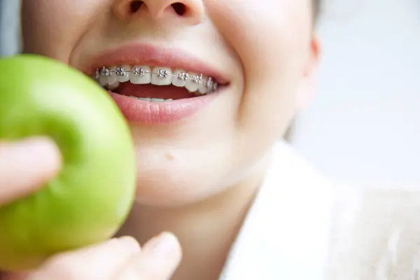 Healthy habits, happy smiles. Cropped photo of young woman in dental braces want to eat fresh green apple. Concept of medicine and beauty, health care and contemporary confidence.