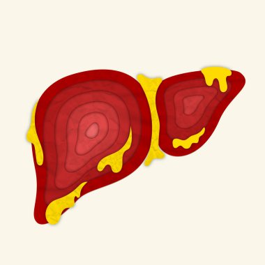 Contemporary art collage. Stylized liver depiction with highlighted areas, representing fatty liver disease and medical awareness for health care. Concept of health insurance, pharmacy, clipart