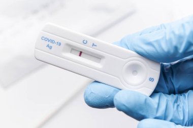 Koruyucu eldivenli doktor COVID-19 için negatif sonuç veriyor. Virüs için test kiti de var.. 