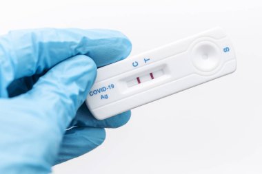 Koruyucu eldivenli doktor COVID-19 için pozitif sonuç verdi. Virüs için test kiti de var..