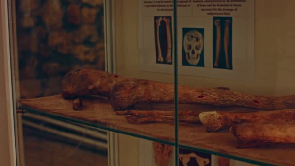 Lidská Lebka Vitríně Starověký Hororový Obchod Strašidelné Muzejní Kosti — Stock video