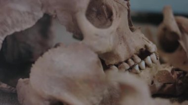 Müzede bir insan kafatası sergisi. Ortaçağ 'ın gerçek insan kafatası