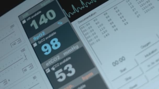 Närbild Skärmen Patientmonitorn Visar Vitala Tecken Ekg Elektrokardiogram Ekg Och — Stockvideo