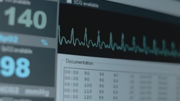 Visualização Perto Tela Monitor Paciente Exibe Sinais Vitais Eletrocardiograma Ecg — Vídeo de Stock