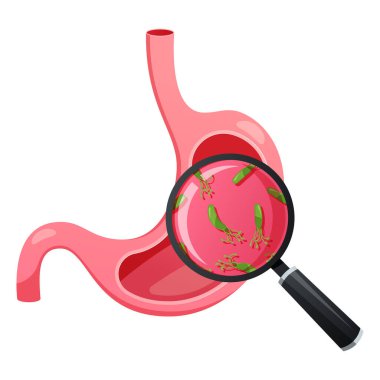 Mide vektöründeki Helicobacter pillori izole edildi