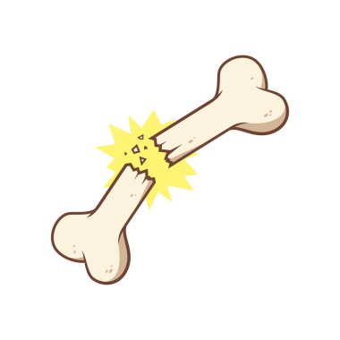 Kırık kemik vektörü izole edilmiş oon beyaz arkaplan.