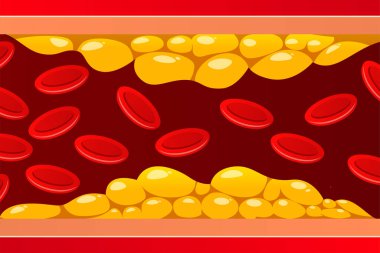 Illustration cholesterol blood vessels bacground. clipart