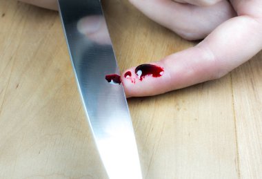 Woman cut her finger with a knife while cooking on the kitchen. Finger with blood, cooking accident.