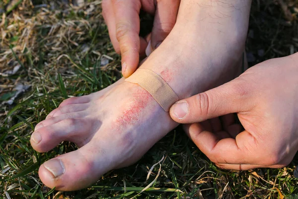 Man Applying Antiseptic Band Aid Plaster His Leg Person Sitting — 图库照片