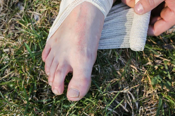 Man Putting Bandage Sprained Ankle Twisted Leg Person Sitting Nature — Stock Photo, Image