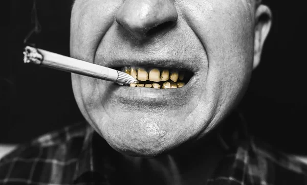 Сигарета Роті Чоловіка Зубні Пустелі Парадонтоз Куріння Викликає Проблеми Карієсом — стокове фото