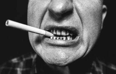 Adamın ağzında sigara var. Diş çürükleri ve paradontosis. Sigara içmek diş çürümesine ve kötü gülümsemeye neden olur. Dişçi tedavisi konsepti. Zararlı alışkanlık..