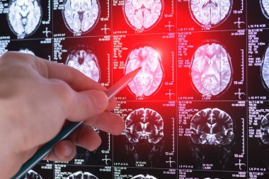 MRI, MRT ve CT 'yi inceleyen bir doktor.