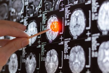 MRI, MRT ve CT 'yi inceleyen bir doktor.