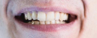 Adam dişleriyle gülümsüyor. Yaklaş, erkeğin ağzı ve dudakları.