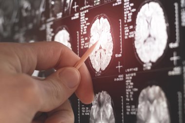 MRI, MRT ve CT 'yi inceleyen bir doktor.