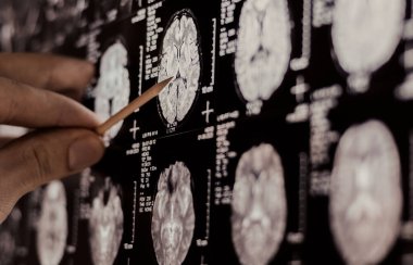 MRI, MRT ve CT 'yi inceleyen bir doktor.