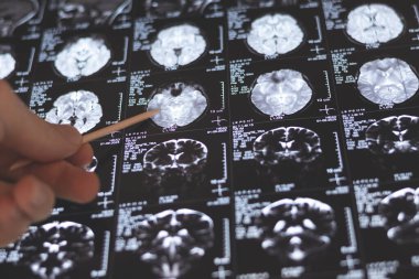 MRI, MRT ve CT 'yi inceleyen bir doktor.