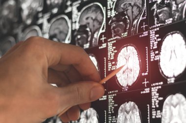 MRI, MRT ve CT 'yi inceleyen bir doktor.