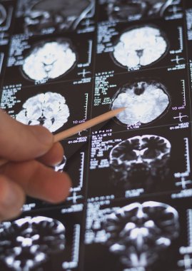 MRI, MRT ve CT 'yi inceleyen bir doktor.
