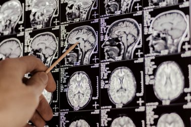 MRI, MRT ve CT 'yi inceleyen bir doktor.