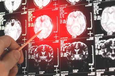MRI, MRT ve CT 'yi inceleyen bir doktor.