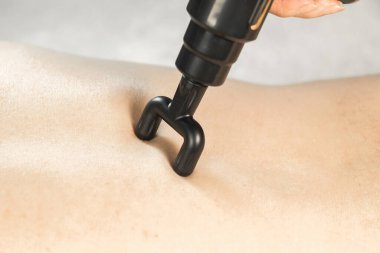 Omurgası için perküsyon masaj tabancasıyla masaj yapan kadın rahatlayıp iyileşiyor. Fizyoterapi, rehabilitasyon, kas düzeltme aleti. Sağlık hizmetleri. Kapat..