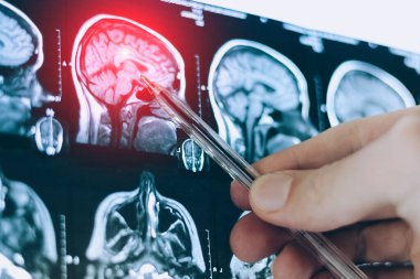 İnsan beyninin tomografi görüntüsü. Tanısal insan kafa hastalıkları için MRI veya X-ray taraması.