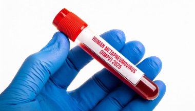 Human Metapneumovirus (HMPV) blood test china New virus 2025 clipart