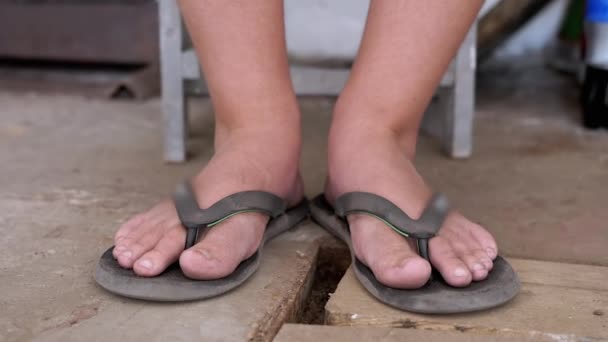 Poor Child Moving Dirty Bare Feet Wiggling Fingers Doing Relaxation — Vídeo de stock