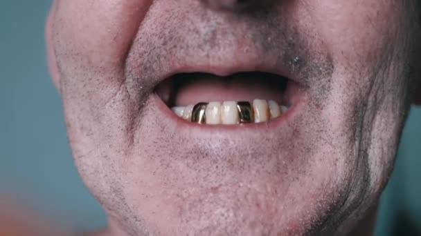 Laughing Cheerful Elderly Pensioner Inserts Dental Upper Jaw Mouth Glimlachend — Stockvideo