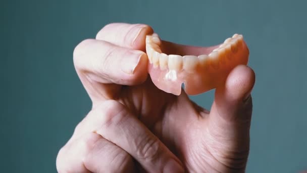 Hand Elderly Holding Removable Upper Jaw Denture Θολό Φόντο Κλείσε — Αρχείο Βίντεο