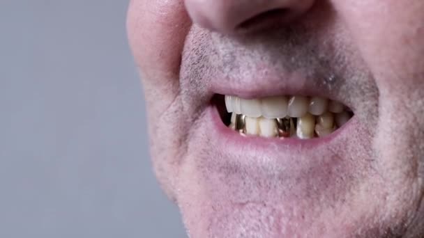 笑老年男性养老金领取者与假牙和金牙 一个老人的脸上有皱纹 没有刮胡子 他有白色的假牙 嘴里有人造的上颚 脸的一部分 — 图库视频影像