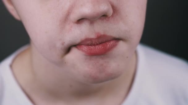 Κοντινό Πλάνο Child Chews Chewing Gum Και Μετά Τεντώστε Έξω — Αρχείο Βίντεο