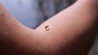 Ormanda Sivrisinek Eline Kan İçen Doğanın Bulanık Geçmişinde. Kapatın. Böcek kanı emici. Vücut parçası. Gnat kan emer. Enfeksiyon, beyin iltihabı, ateş, virüs sıtması. Huzur içinde yat..
