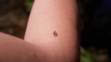 Ormanda Sivrisinek Eline Kan İçen Doğanın Bulanık Geçmişinde. Kapatın. Böcek kanı emici. Vücut parçası. Gnat kan emer. Enfeksiyon, beyin iltihabı, ateş, virüs sıtması. Huzur içinde yat..