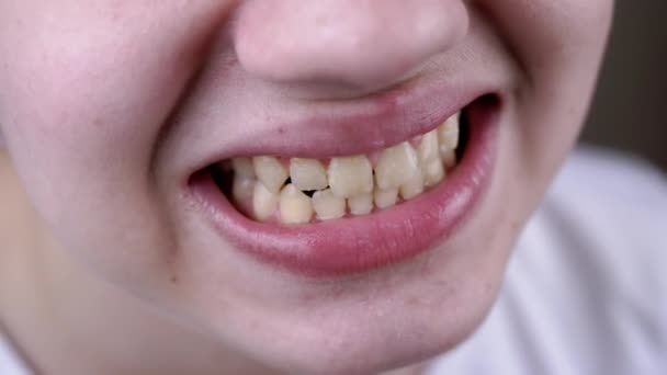 Närbild Ett Brett Leende Tonåring Med Raka Jämna Tänder Och — Stockvideo