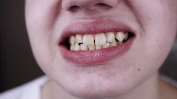 Κοντινό Πλάνο Πλατύ Χαμόγελο Ενός Έφηβου Ίσια Ακόμη Και Δόντια — Αρχείο Βίντεο