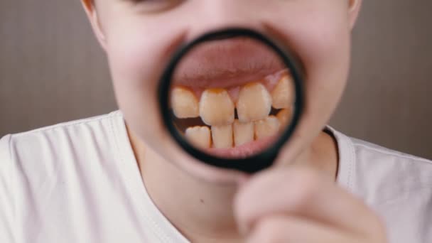 Boy Showing Wide Toothy Smile Dental Plaque Magnifying Glass Dalam — Stok Video