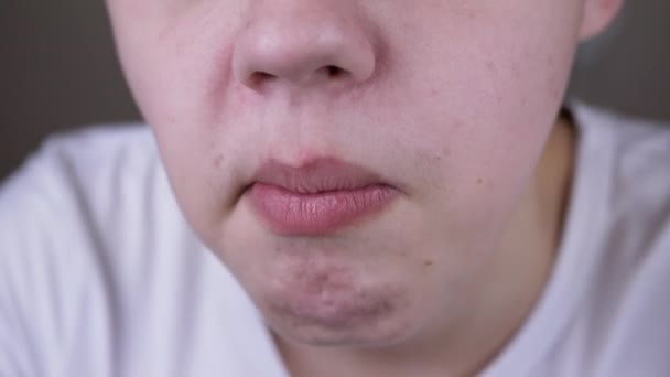 Zblízka Dítě Žvýká Žvýkačku Rozmazaném Pozadí Ukazuje Zuby Portrét Část — Stock video