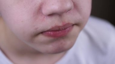 Yaklaş, Çocuk Çiklet Çiğniyor, Sonra da Ağzından Elle Esnet. Sakız yırtılmış. Çene hareketi. Gülen çocuk sakız tadını sever. Yemekten sonra yemek yememek. Dişçilik.