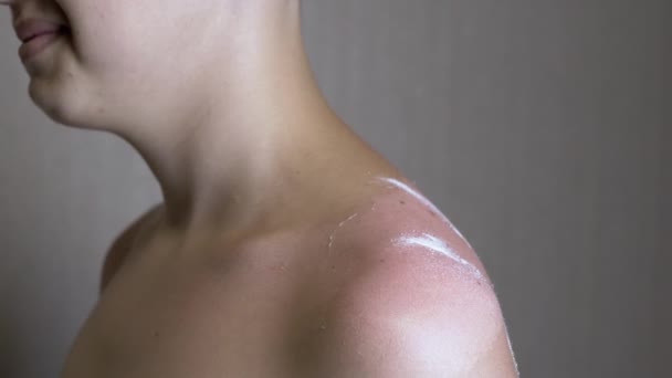 Close Female Hand Rubs Sunscreen Burns Boy Shoulder Indoors Part — Stock Video