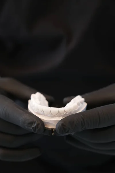 Dentist Black Gloves Holding White Dental Prosthesis Close White Dental — Stock Photo, Image