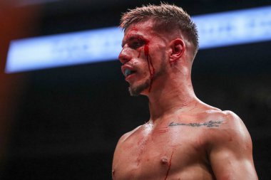 Alin Florin Ciorceri, 11 Kasım 202 'de Utilita Arena, Sheffield, Birleşik Krallık' ta Sunny Edwards 'a karşı Felix Alvarado maçında Levi Kinsiona' nın Alin Florin Ciorceri 'ye açtığı davada gözünden kan geliyor.