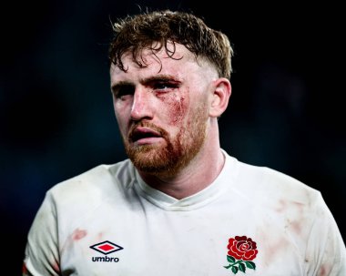İngiltere 'den Ollie Chessum, 2025 Guinness maçında sol gözünden derin bir yarayla 6 ülke İskoçya' ya karşı Allianz Stadyumu, Twickenham, Birleşik Krallık, 22 Şubat 2025